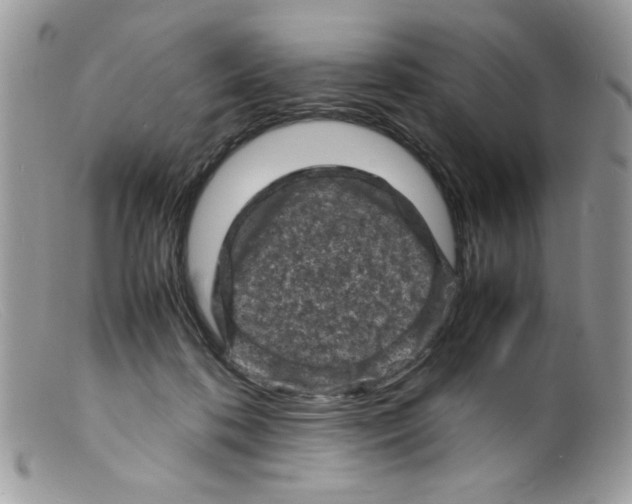 X0000098160316200805151235