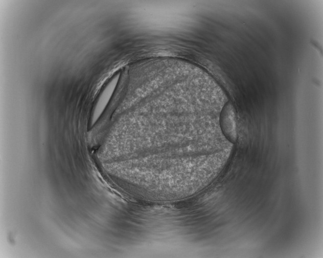 X0000098160386200805151234