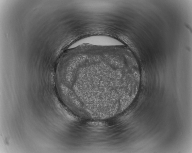 X0000098160449200805151233