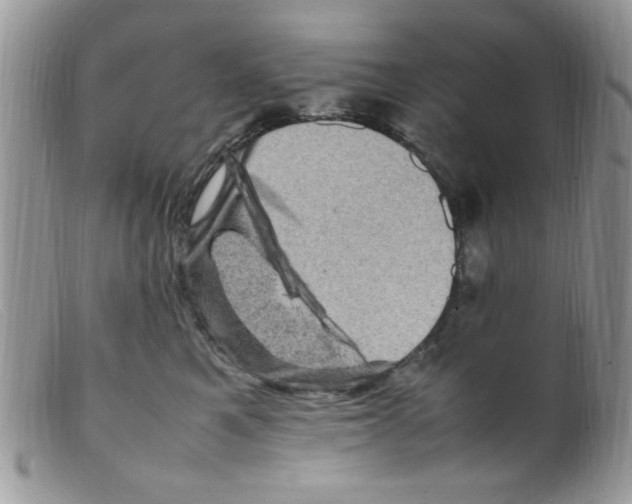 X0000098160521200805151232