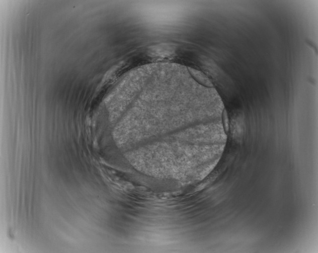 X0000098160570200805151232