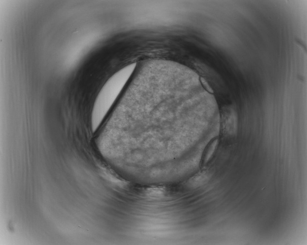 X0000098160574200805151232