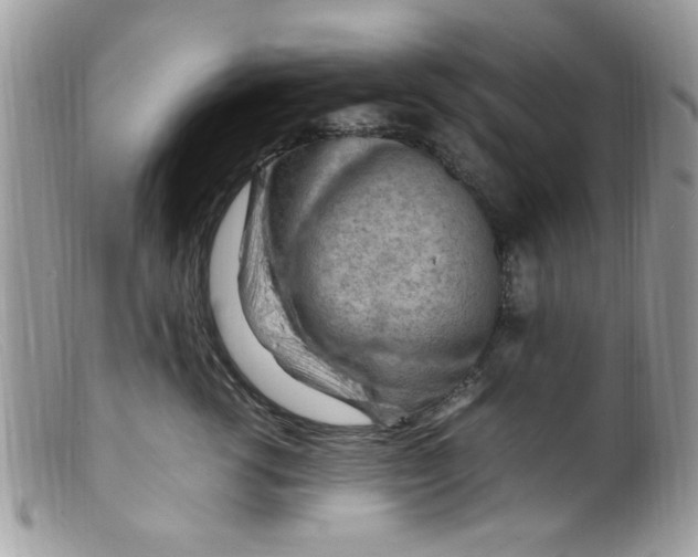 X0000098160762200805151229