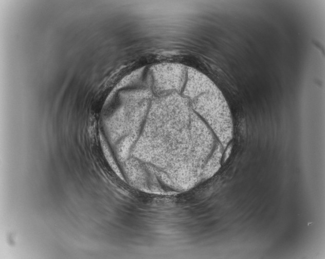 X0000098160914200805151225