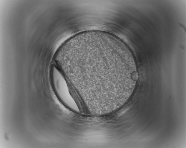 X0000098160991200805151225