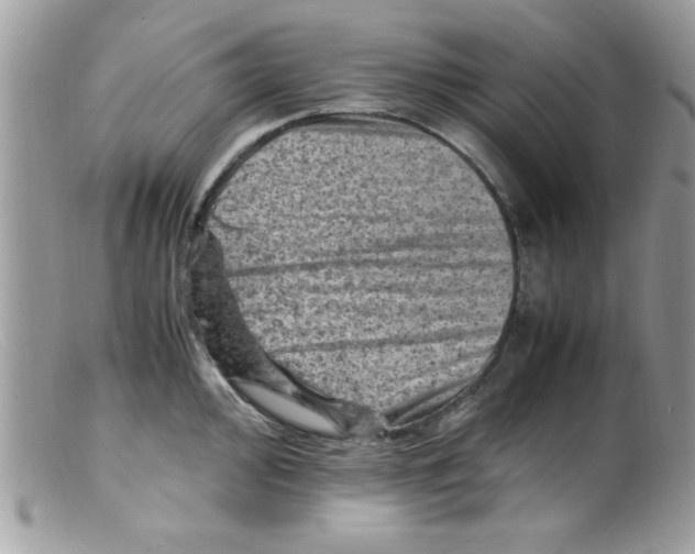 X0000098161000200805151225