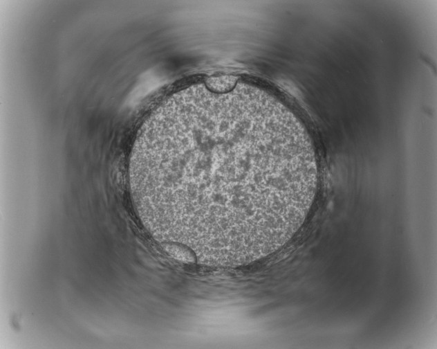 X0000098161063200805151224