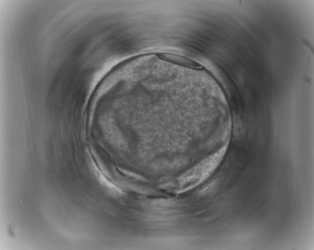 X0000098161102200805151223