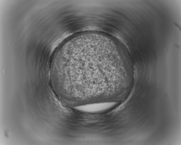 X0000098161117200805151222