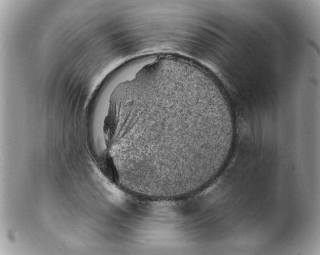 X0000098161118200805151222