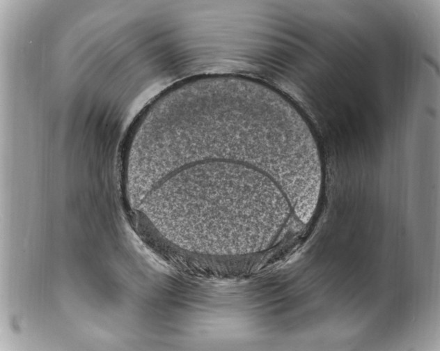 X0000098161122200805151222