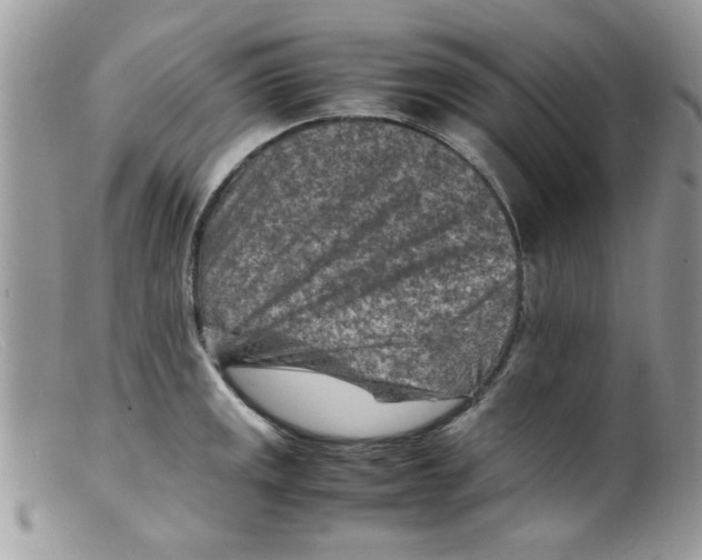 X0000098161141200805151223