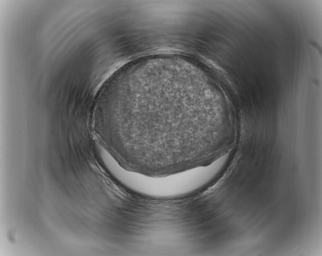 X0000098161170200805151222