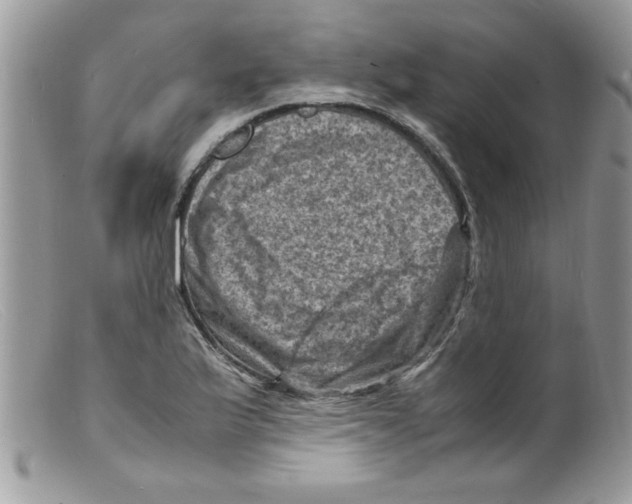 X0000098161175200805151222