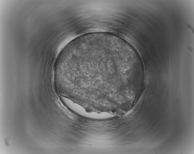 X0000098161179200805151222