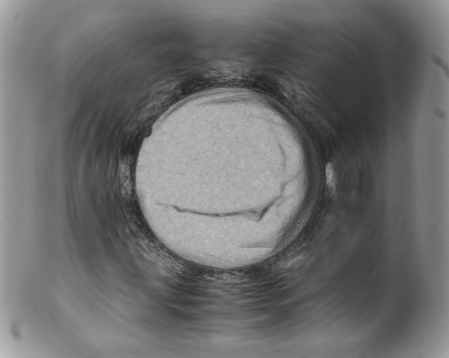 X0000098161203200805151221