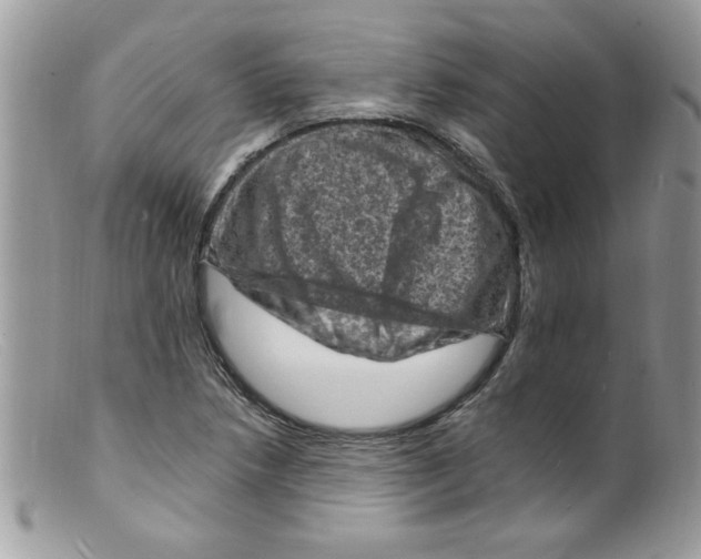 X0000098161218200805151221