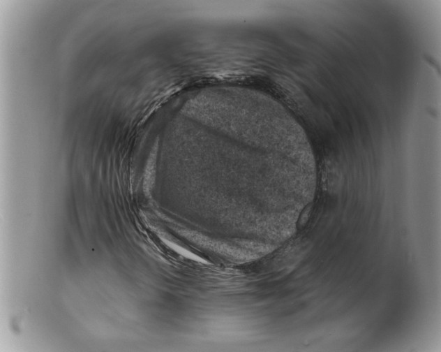 X0000098161298200805151219