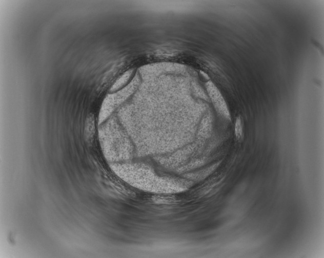 X0000098161299200805151219