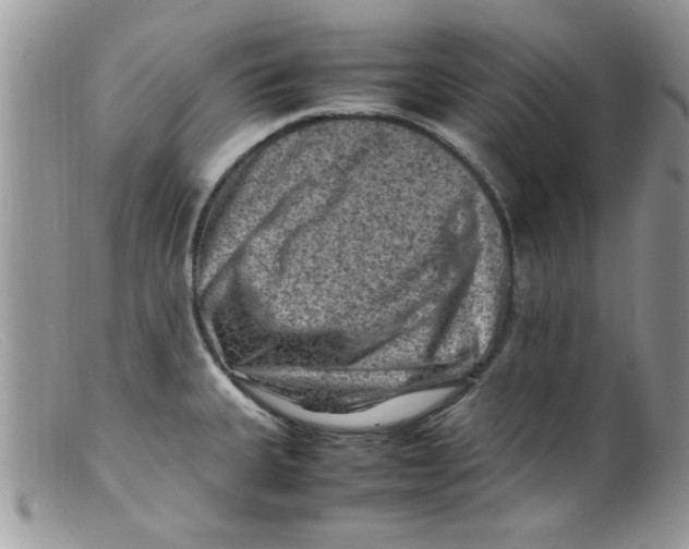 X0000098161335200805151220