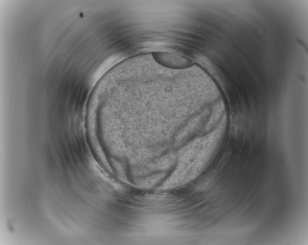 X0000098161386200805151218