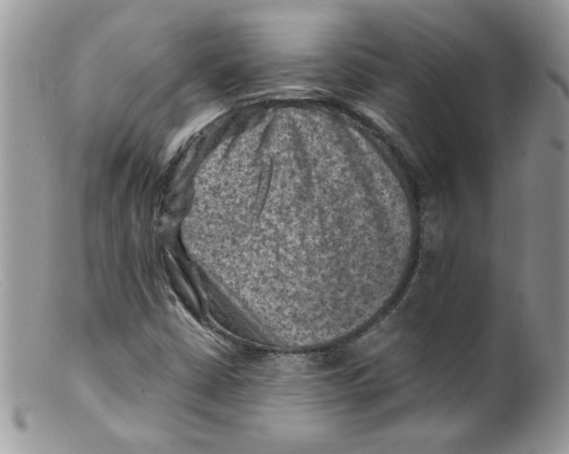 X0000098161402200805151218