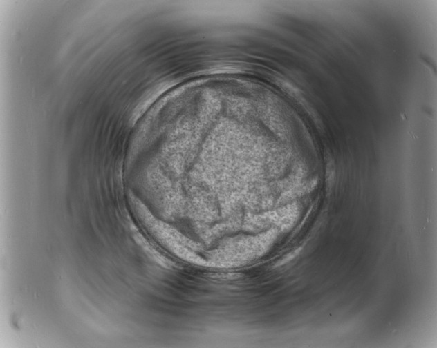 X0000098161417200805151218