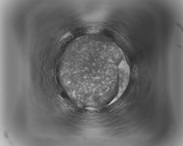 X0000098161441200805151218