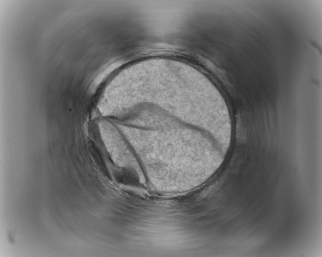 X0000098161453200805151217