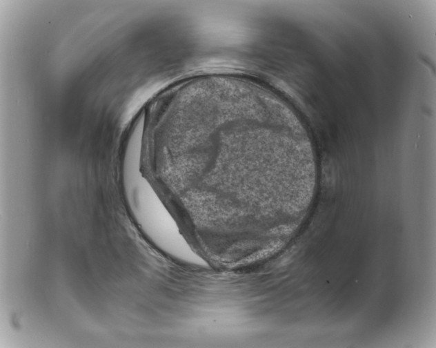 X0000098161461200805151217