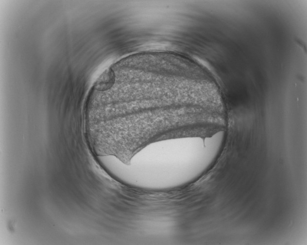 X0000098161467200805151217