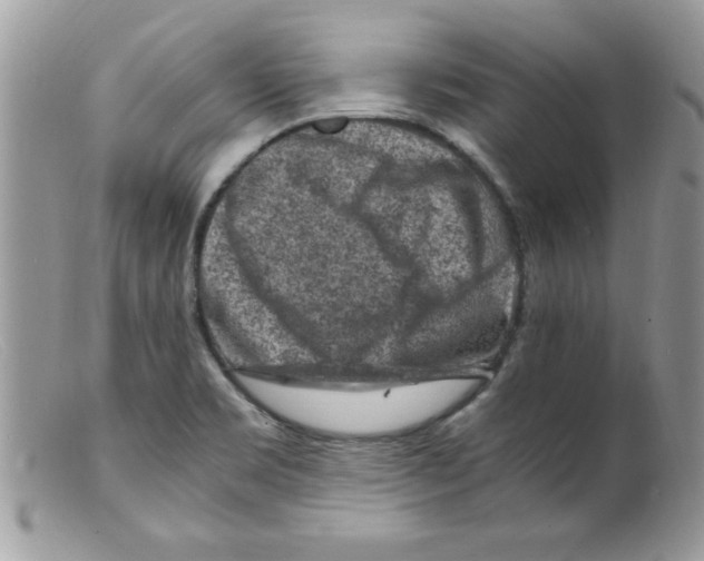 X0000098161469200805151217