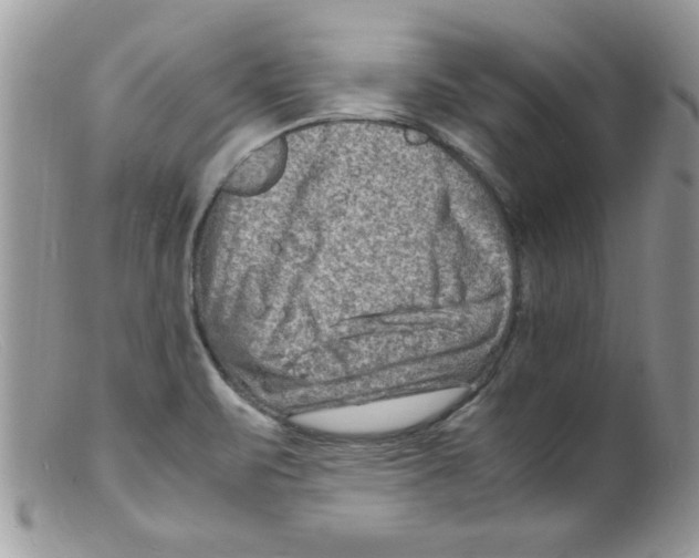 X0000098161471200805151217
