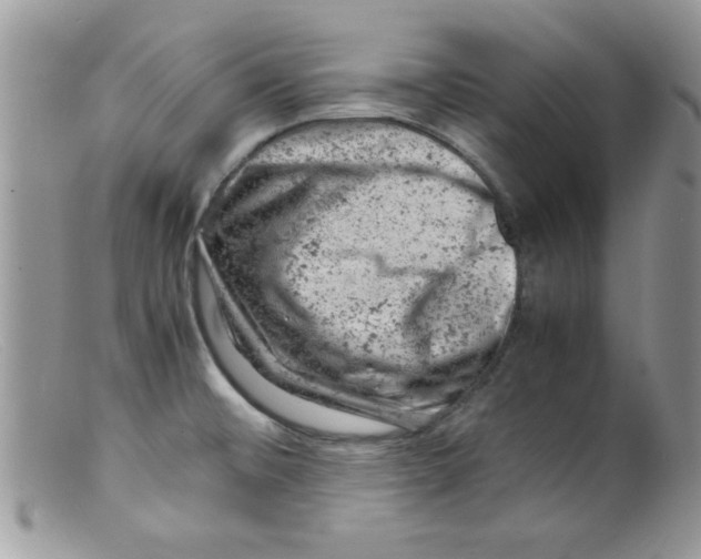 X0000098161476200805151217