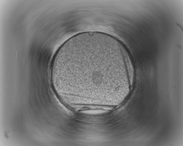 X0000098161517200805151217