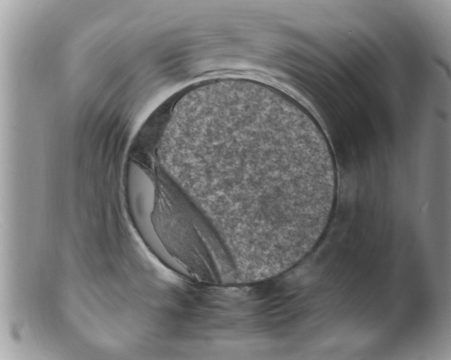 X0000098161533200805151217