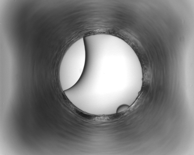 X0000098170179200804241017