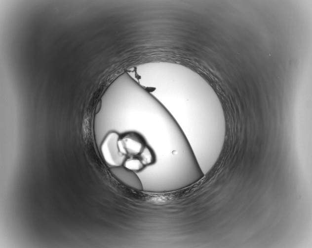 X0000098170611200804241011