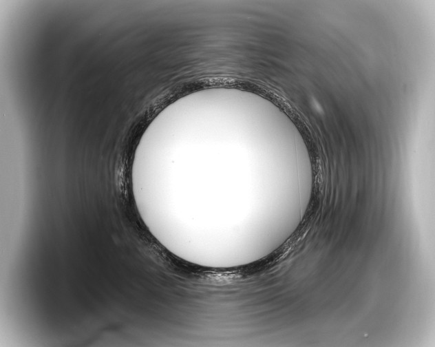X0000098170619200804241011