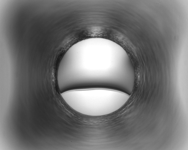 X0000098170620200804241011