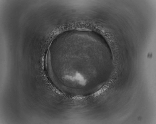 X0000098170192200804241204