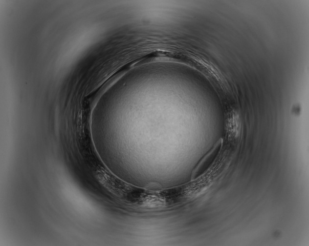 X0000098170572200804241158