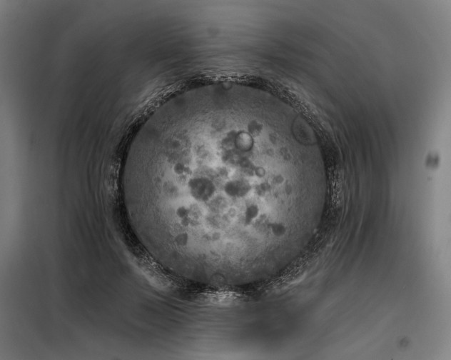 X0000098170695200804241156