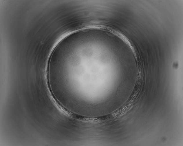 X0000098170811200804241154