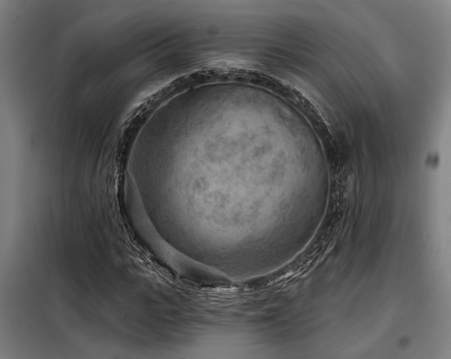 X0000098170919200804241152