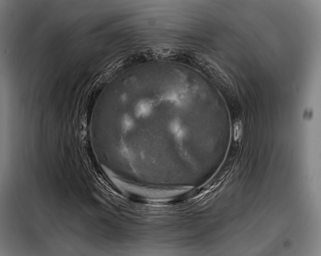 X0000098171011200804241150