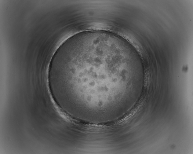 X0000098171039200804241151