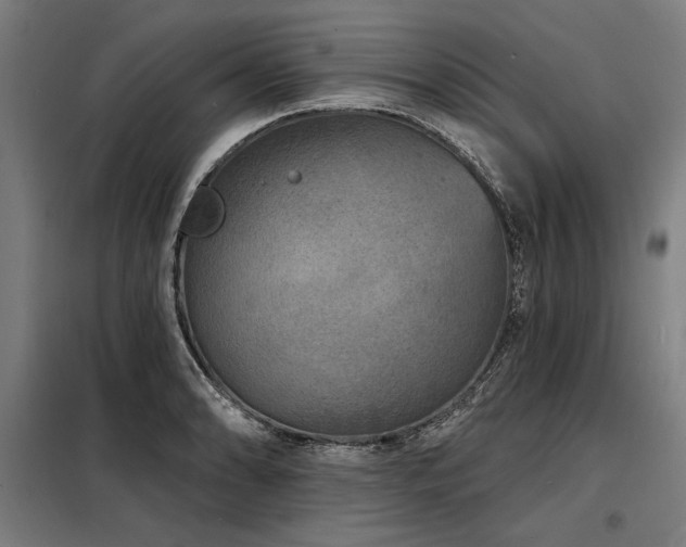 X0000098171086200804241150