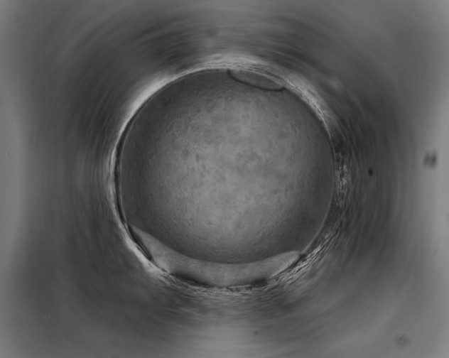X0000098171103200804241150