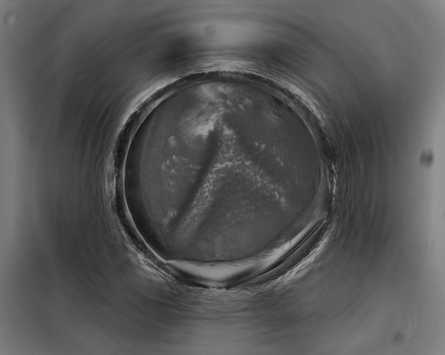 X0000098171117200804241149